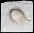 Huge, D Cystoid (Holocystites) From Indiana #11463-3